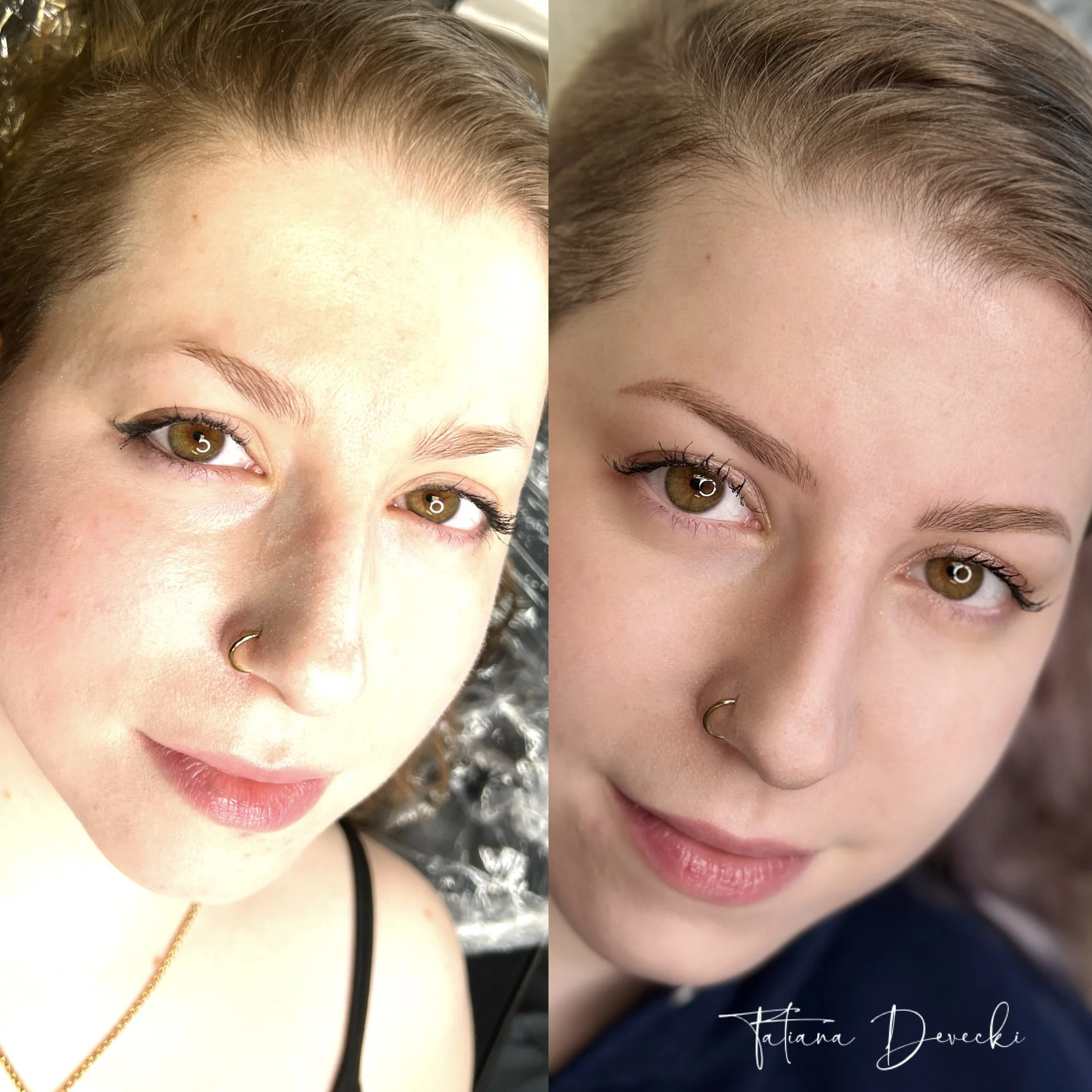 A split image showing a woman's face before and after a cosmetic procedure. The left side depicts fuzzy eyebrows and slightly uneven skin tone, while the right side shows well-defined, shaped eyebrows and clearer skin.