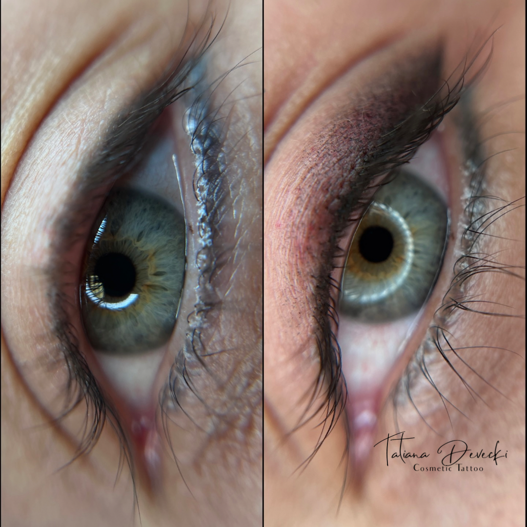 Close-up of a person's eye showing a before-and-after comparison of eyelid tattoo or permanent makeup application.