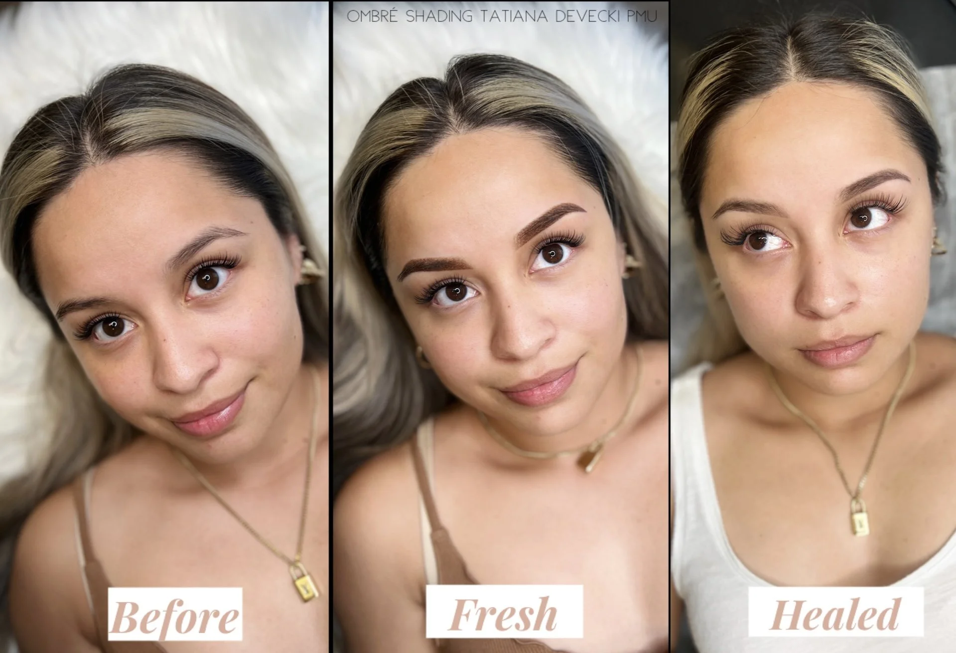 Side-by-side comparison of a woman's face showing her forehead and hair before, during, and after a cosmetic procedure, with the words 'Before,' 'Fresh,' and 'Healed' labeled below each image.