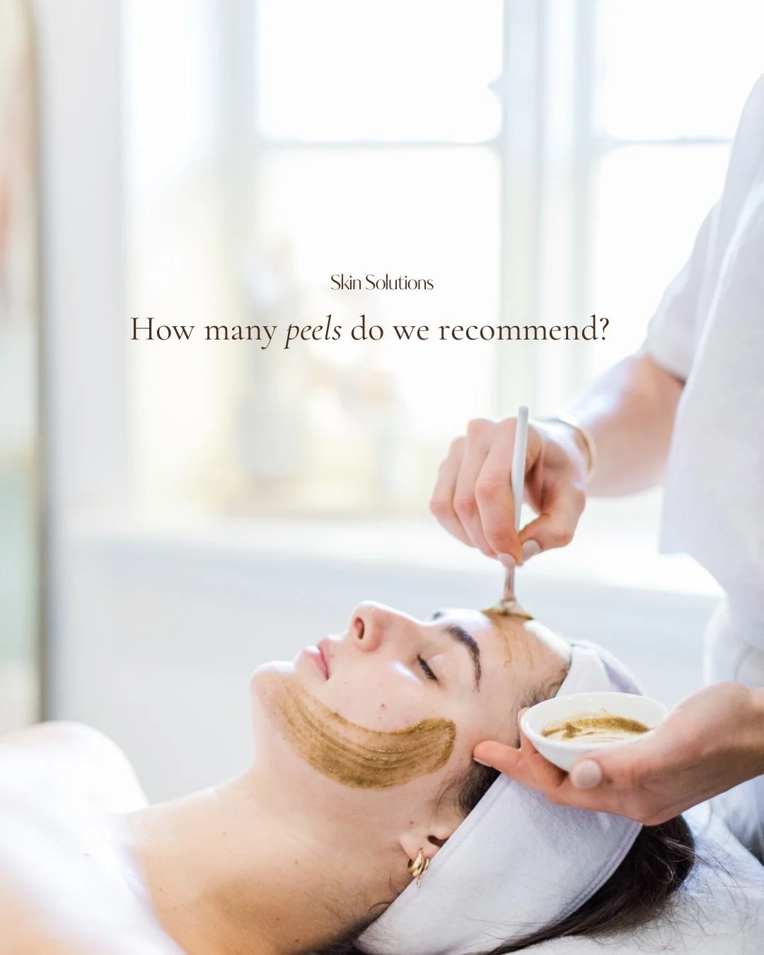 Peel season is here 🙌🏼 ✨

In order to achieve best results, we recommend a commitment of 6 treatments, 2-3 weeks apart.

Your skin, your pace &mdash; let&rsquo;s find the perfect fit together🫶🏼 

#SkinSolutionsWagga