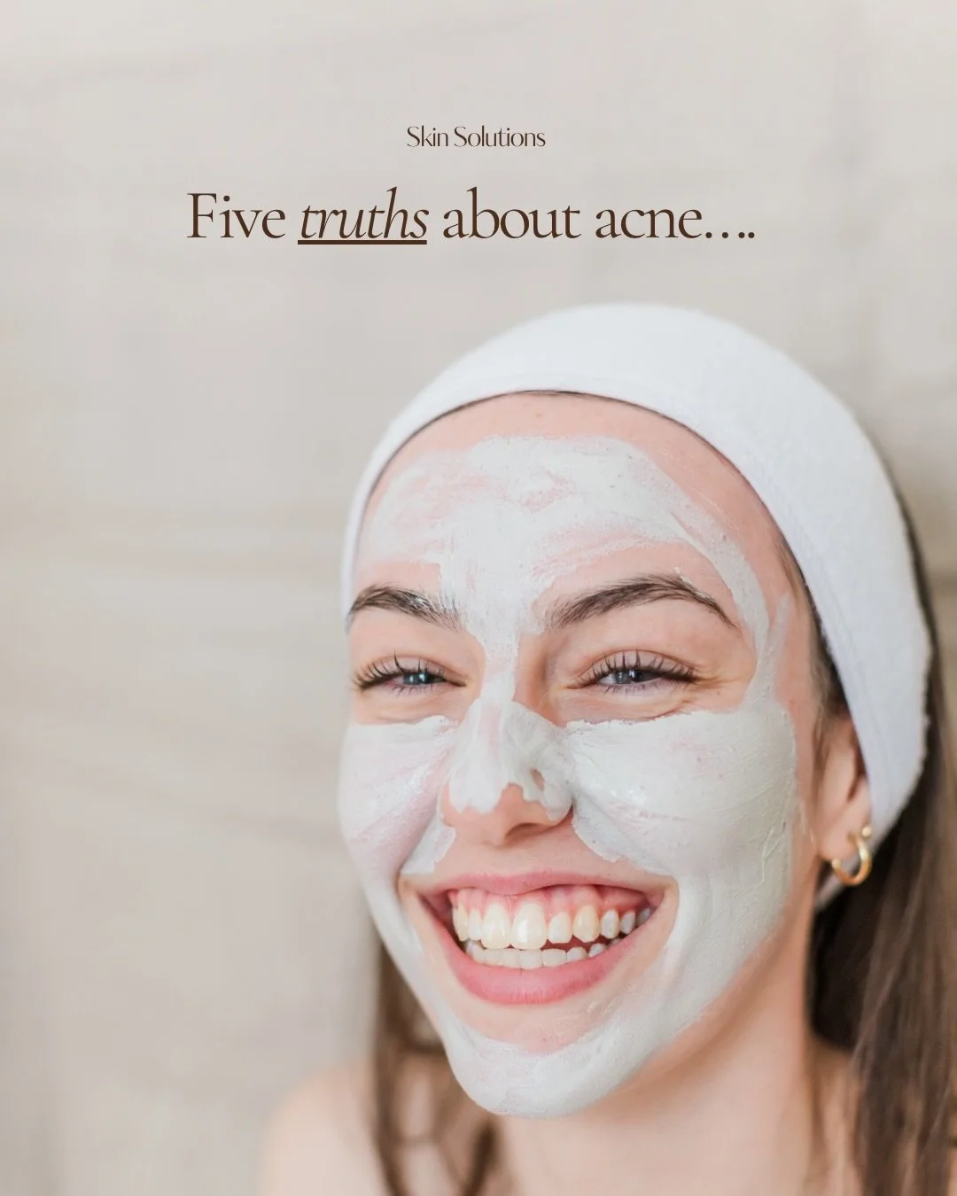 Acne is one of the most common skin concerns we see in clinic, and we love to help treat it!

To start your journey with us book a Clinical Assessment and we can create your customised treatment plan ✨ 

#skinsolutions