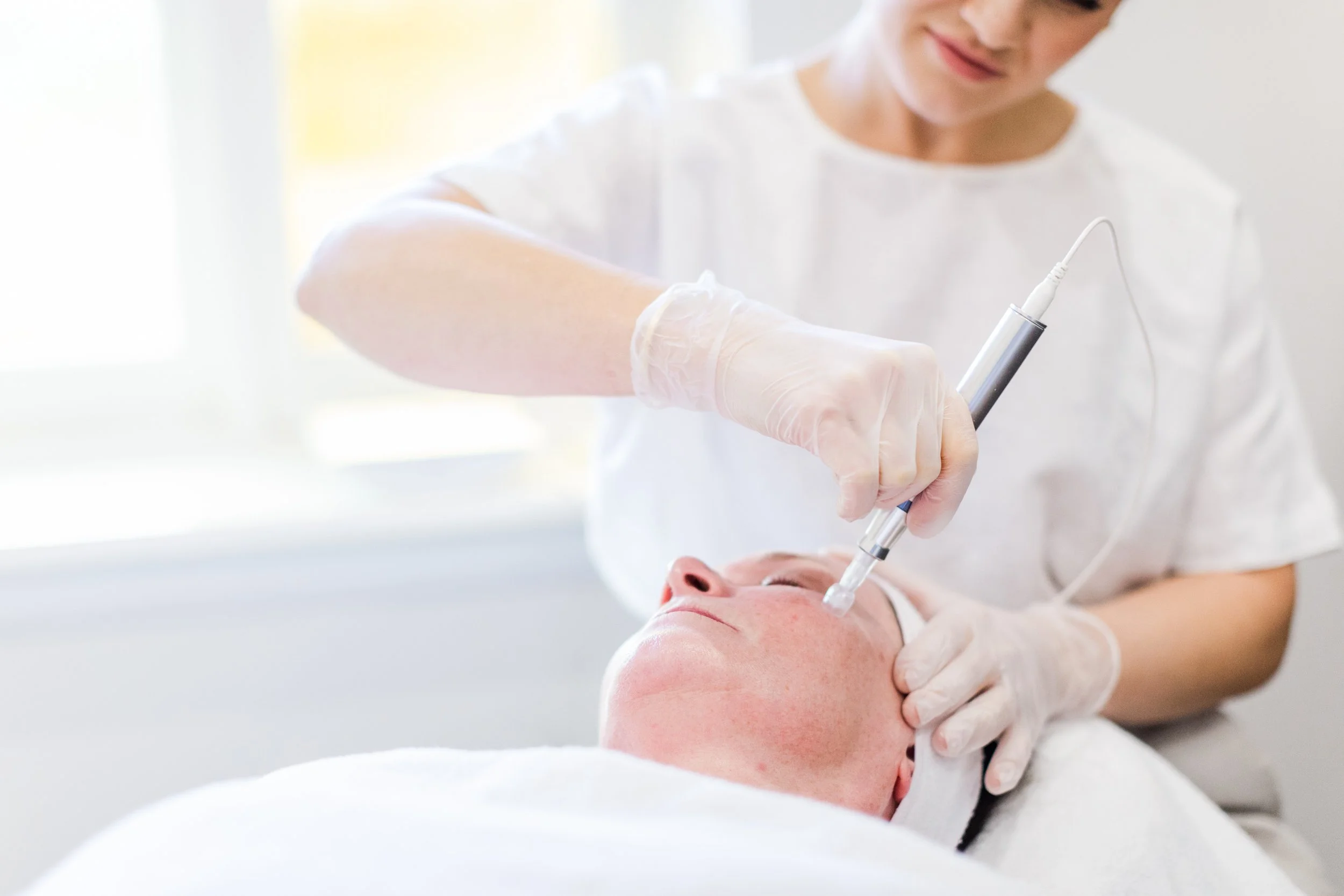 A woman receiving a microneedling treatment using a handheld device at a skincare clinic.