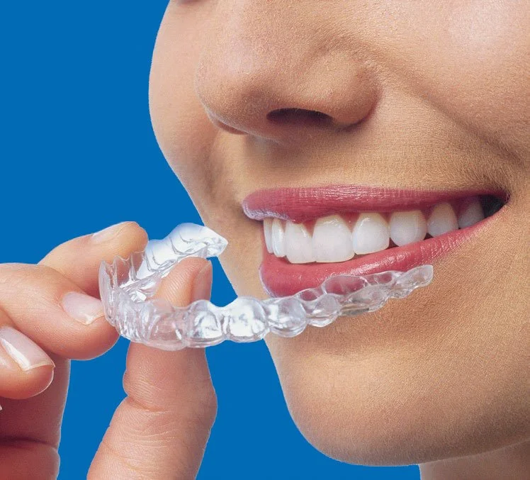 Invisalign.JPG