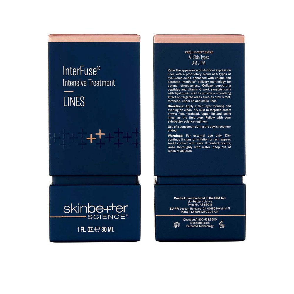 interfuse lines 2.jpeg