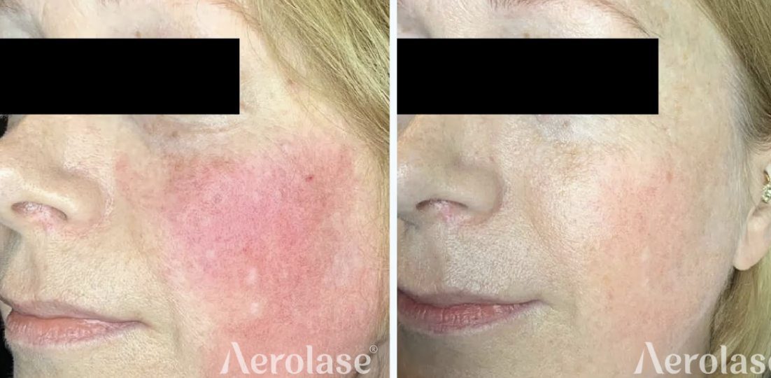 Screenshot 2026-02-24 at 9.54.08 AM.png