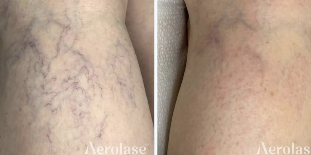 Screenshot 2026-02-24 at 9.54.57 AM.png