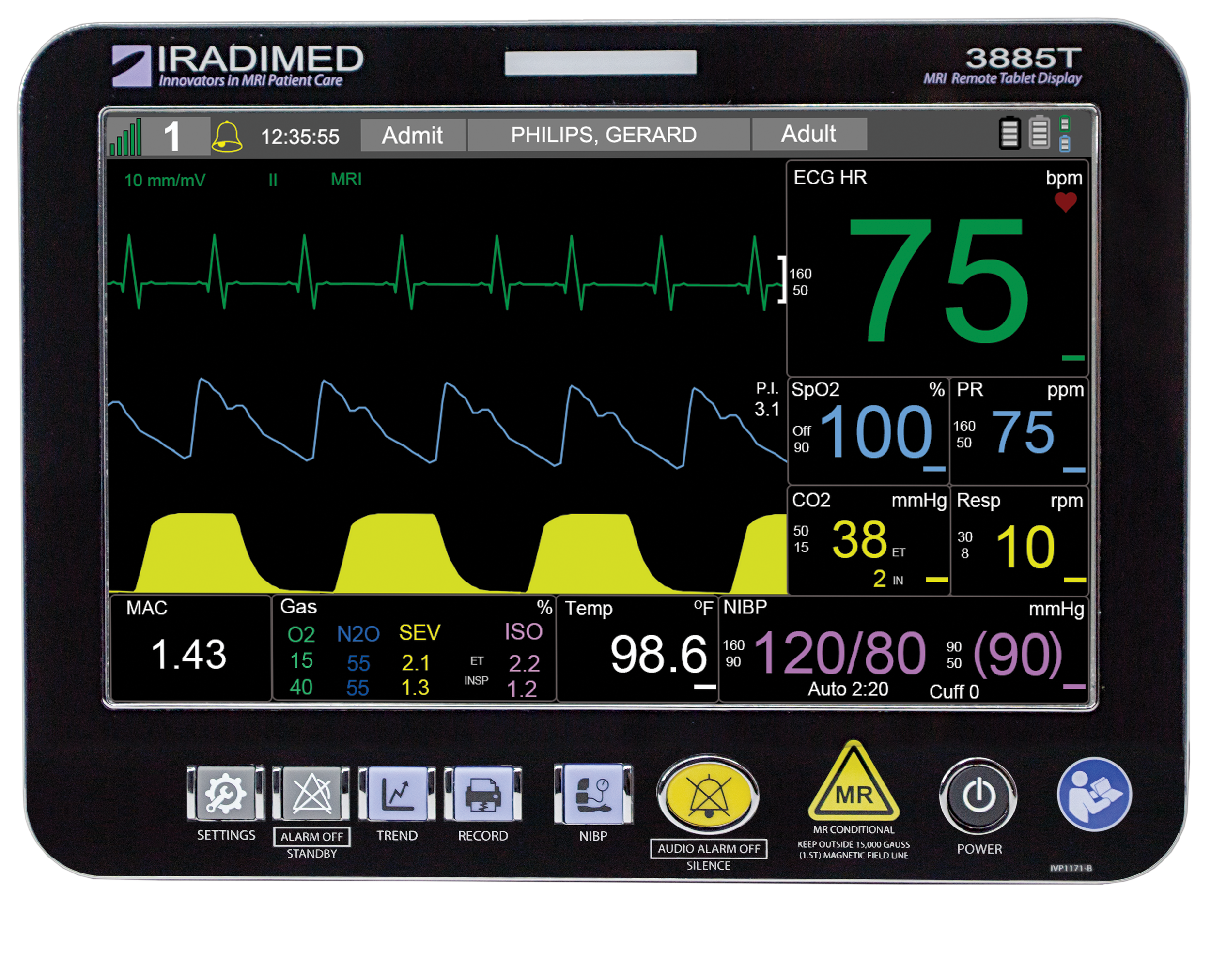 Iradimed 3885 MRI Remote Tablet