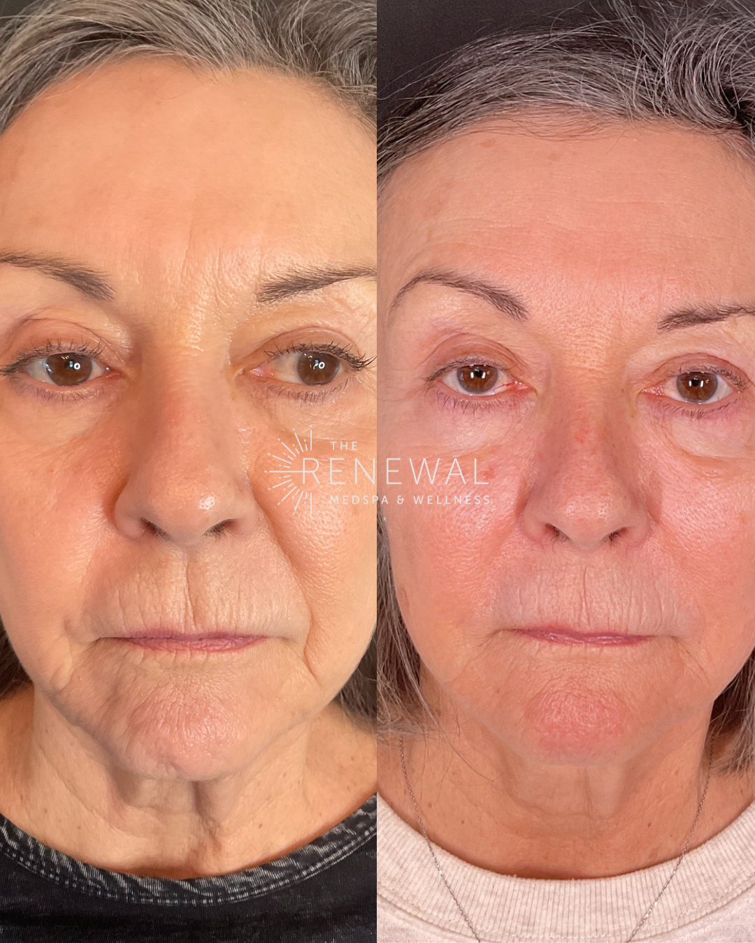 Diane's before and afters.png
