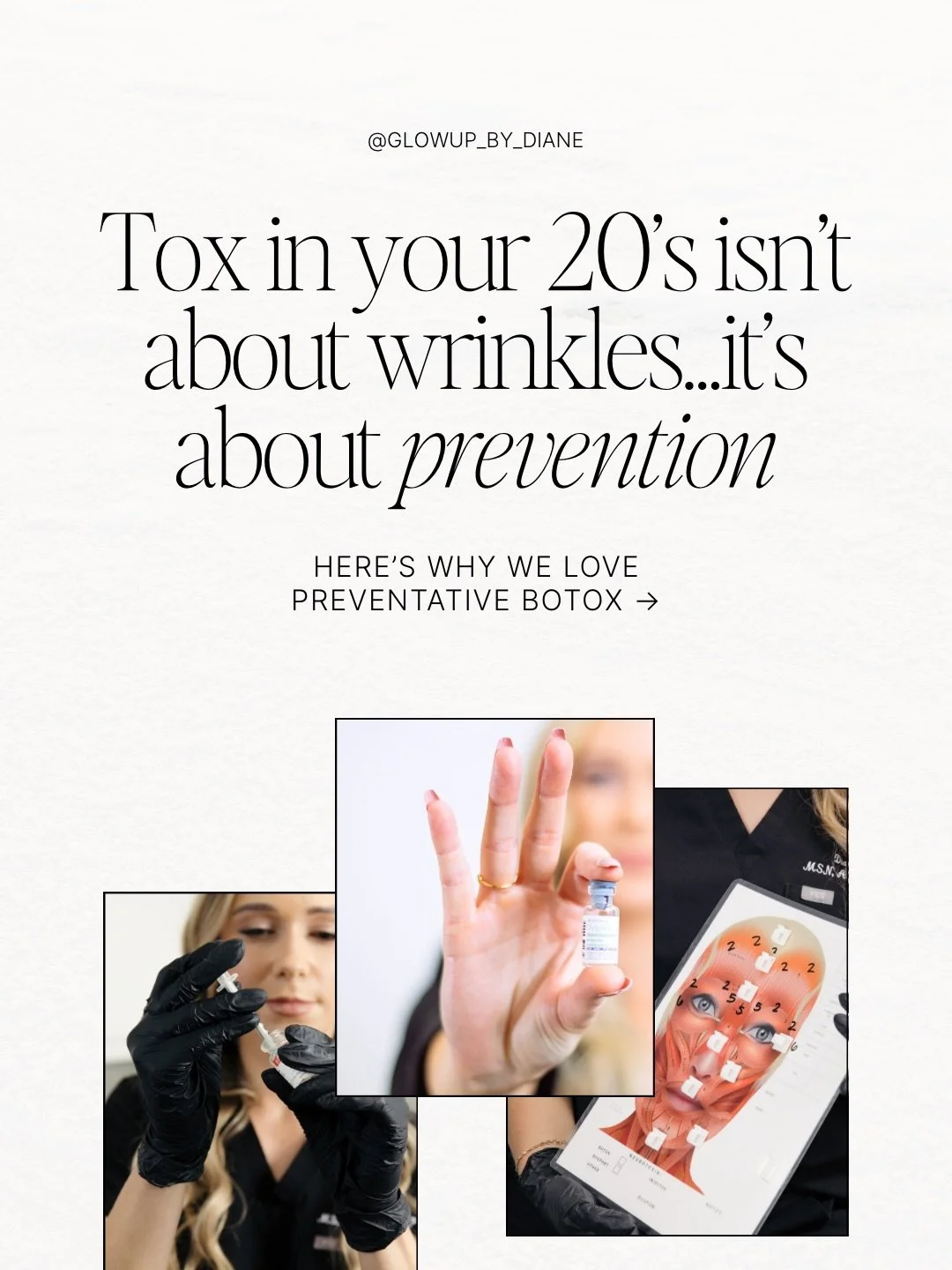 Consider this your Botox &lsquo;soft launch.&rsquo; ☁️

We aren&rsquo;t using Botox in your 20s to change your face, we&rsquo;re using it to &lsquo;future-proof&rsquo; it. By softening movements before deep lines settle in, you stay looking like you 