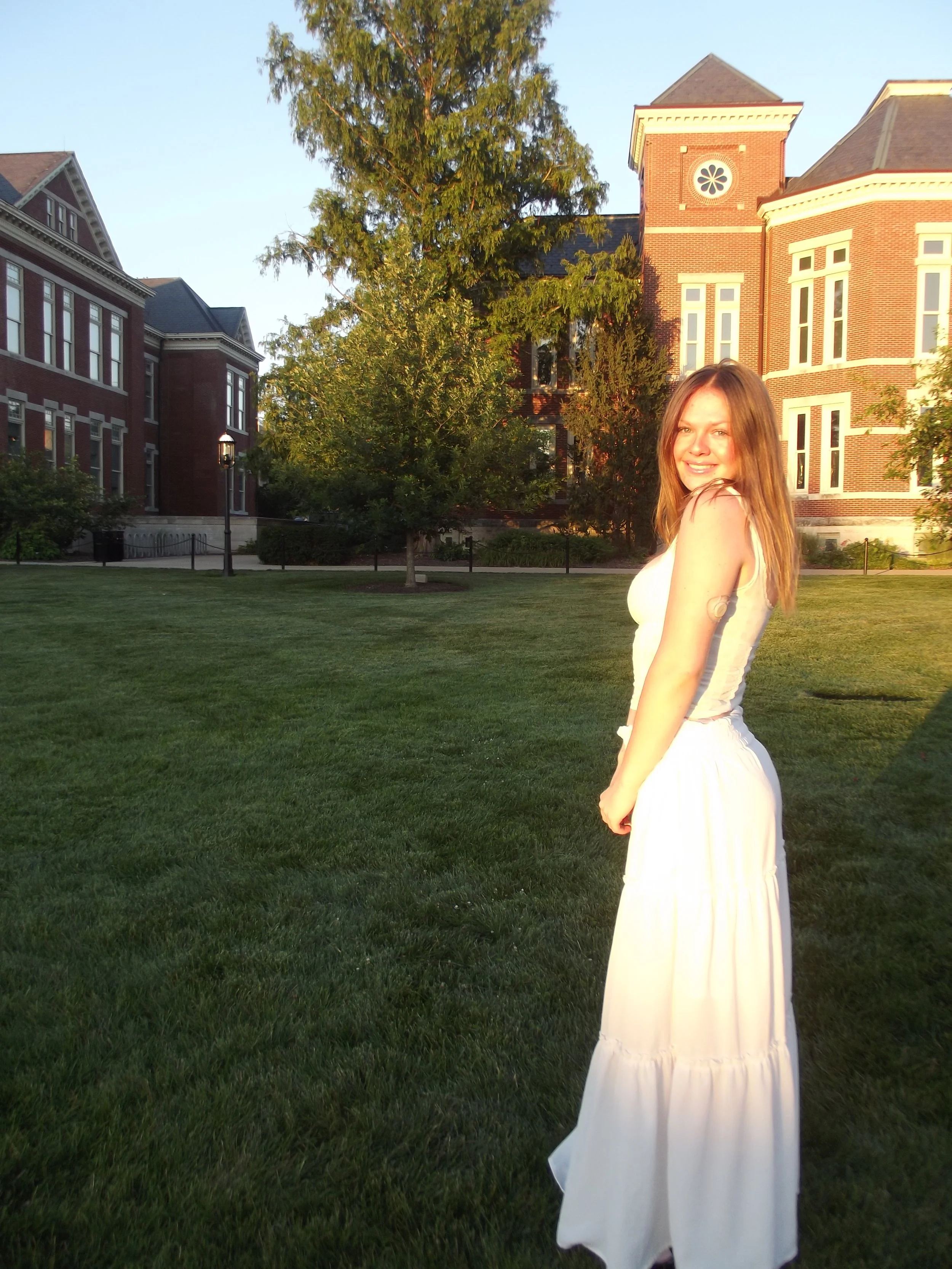 Julia Lipp standing on in a campus lawn wearing a white dress with a diabetic patch on her arm.