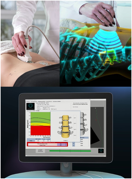 REMS_technology_spine_scan.png