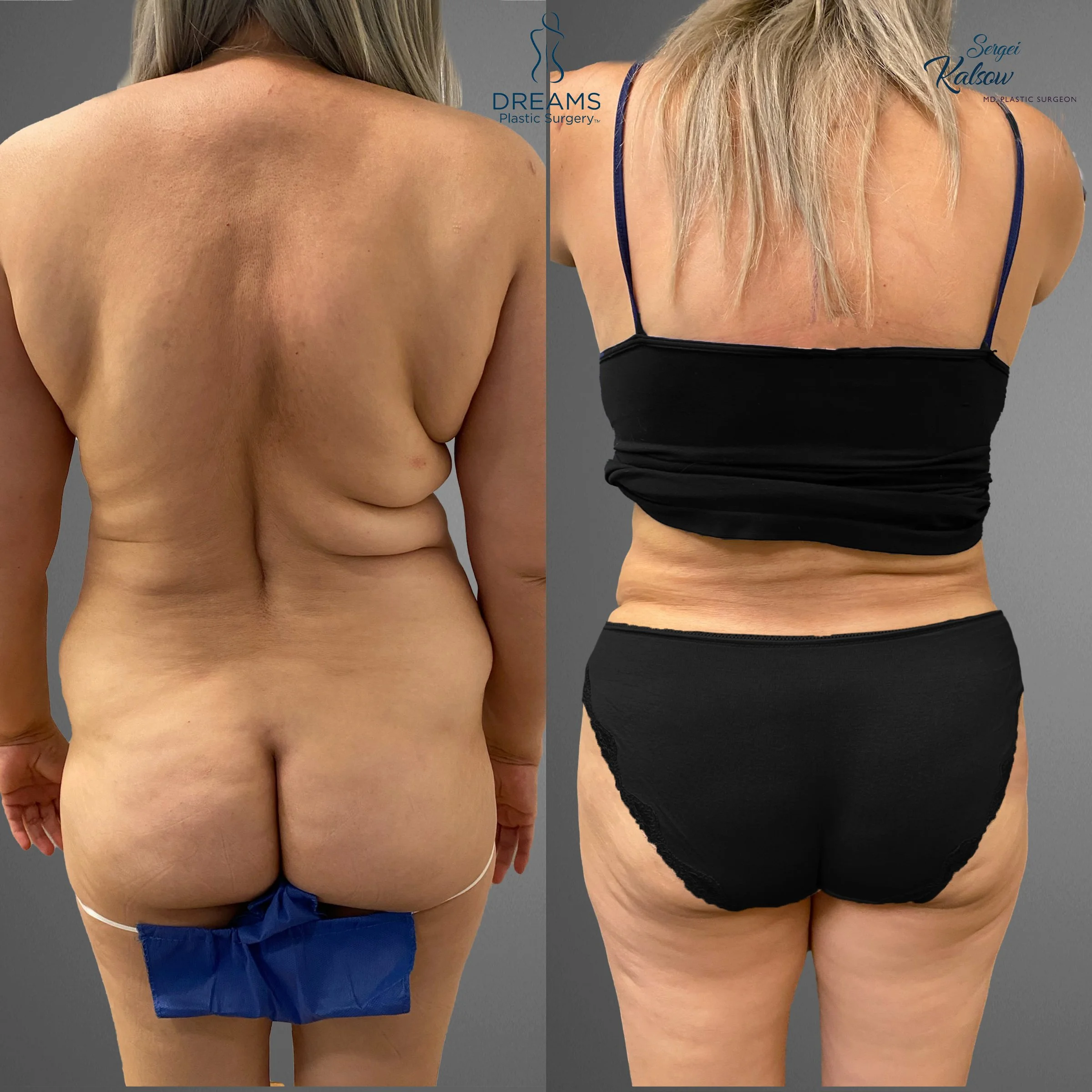back.jpg