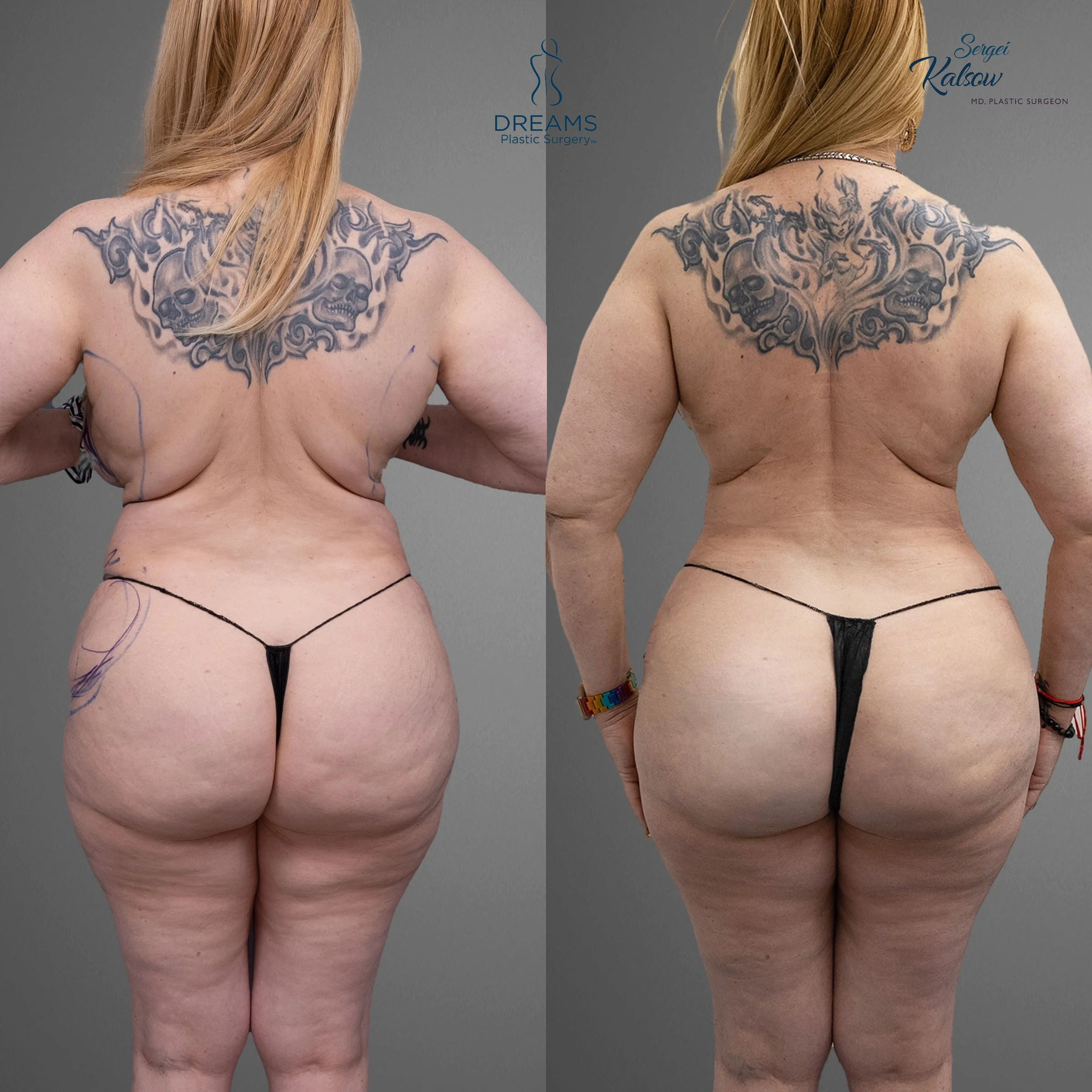 backj.jpg