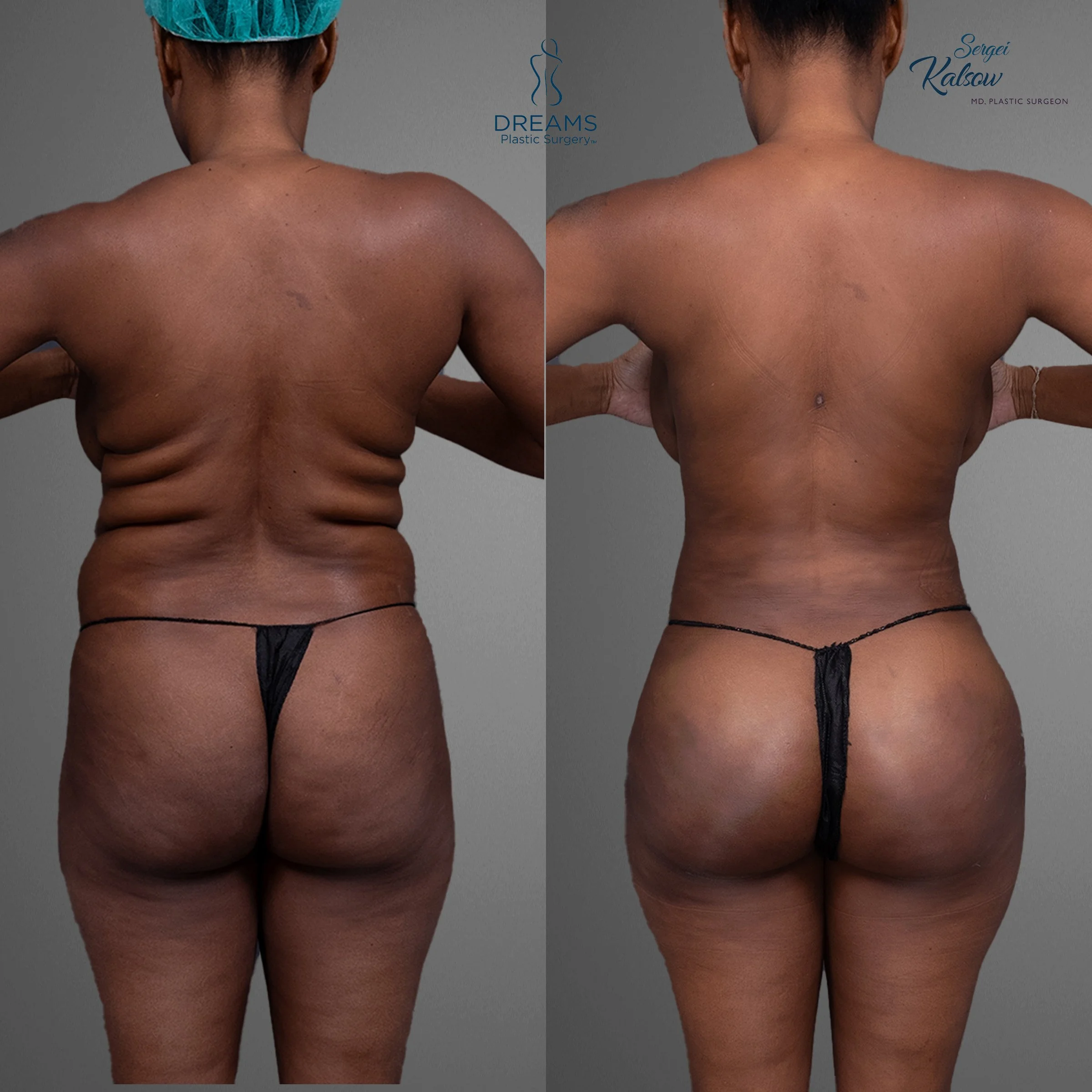 back.jpg