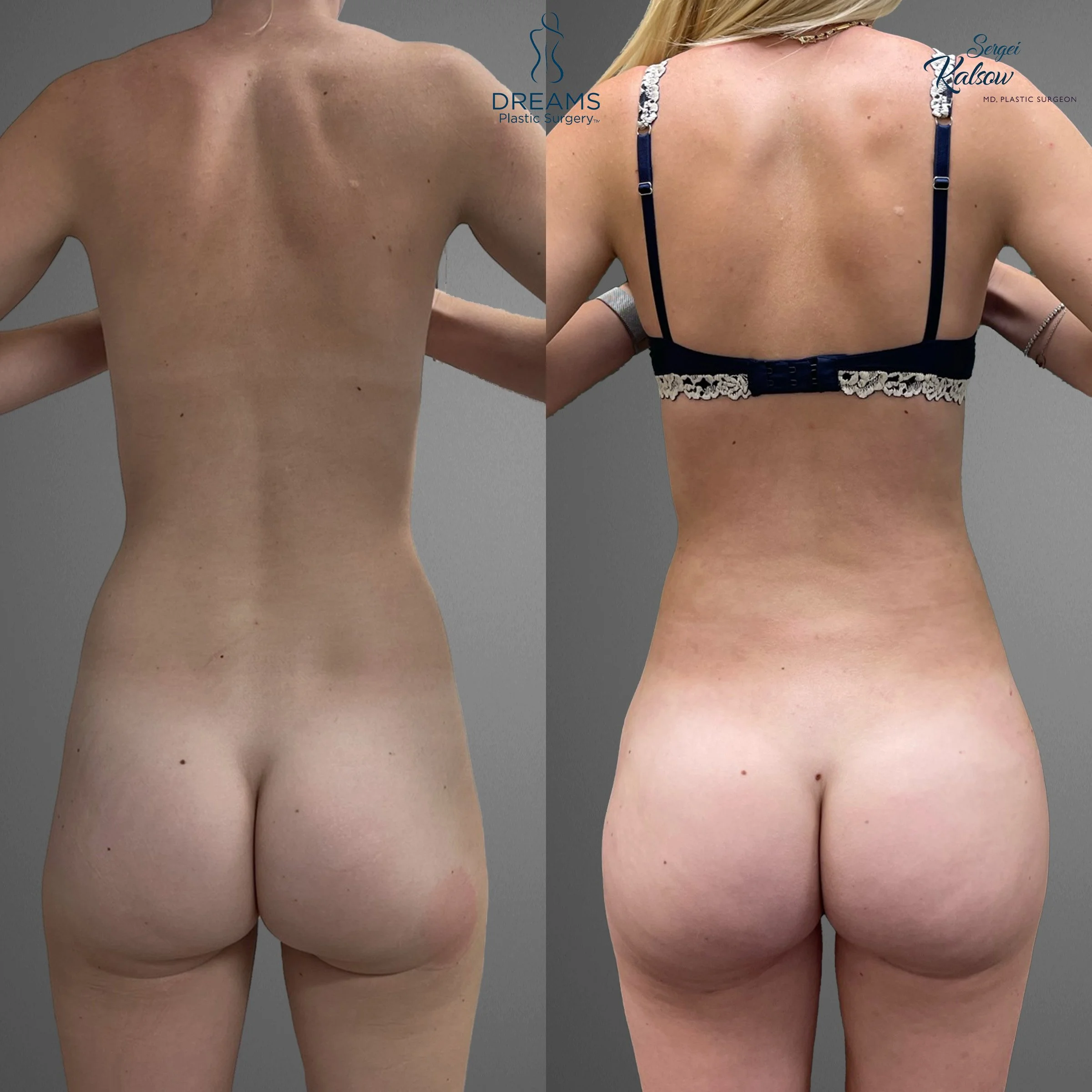 back.jpg