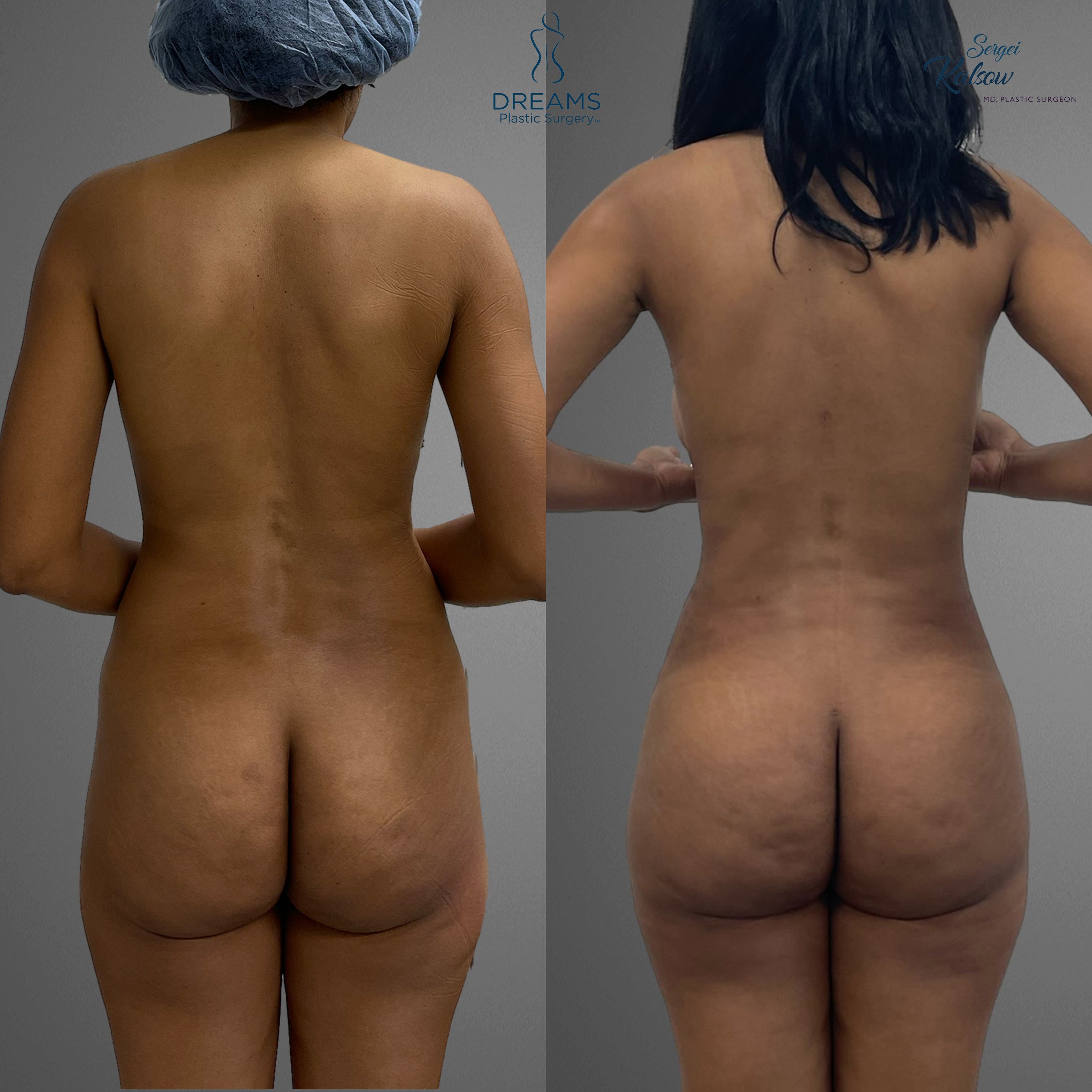 back.jpg