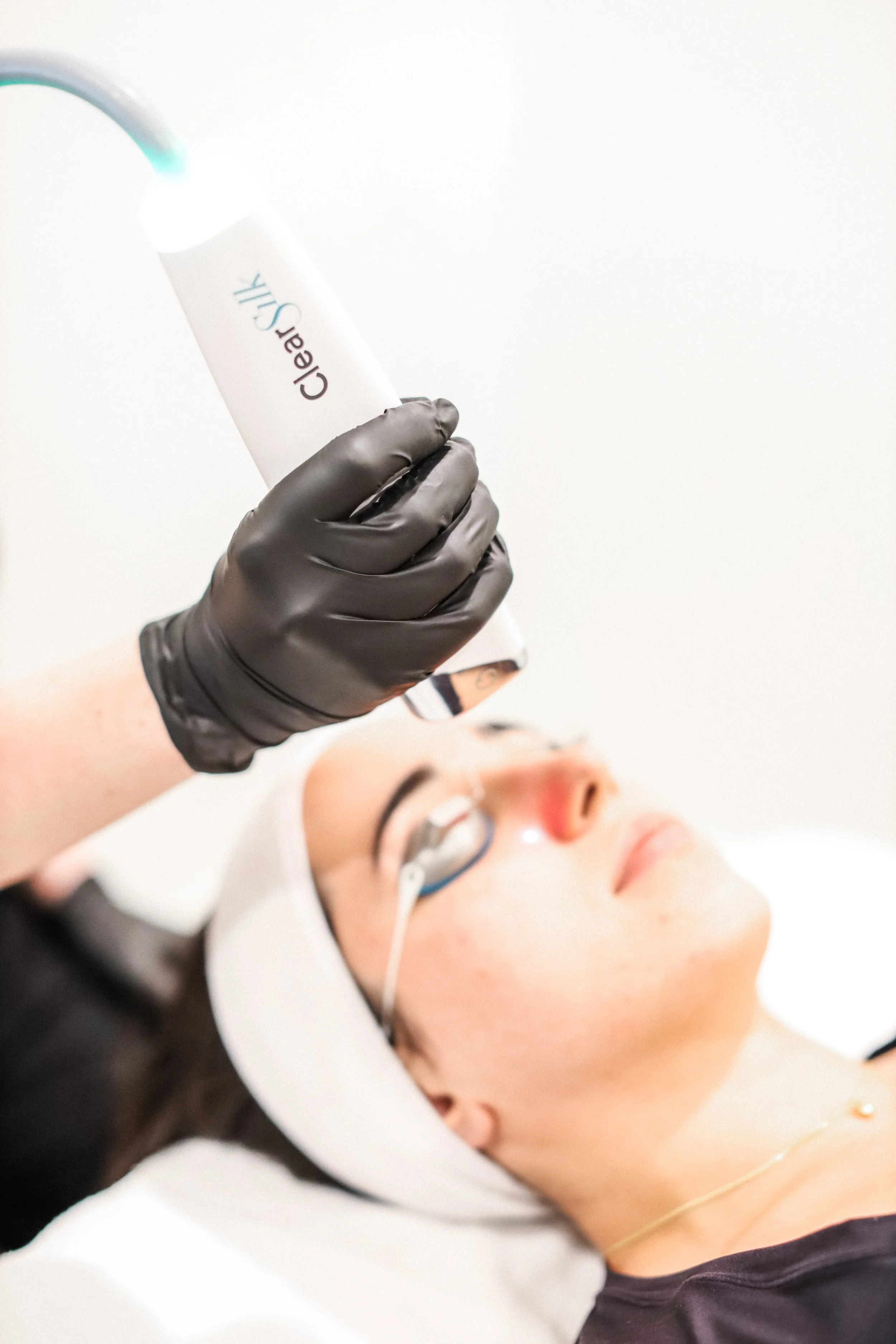 Experience Clear, Radiant Skin With Our Advanced Laser Facial at Habit