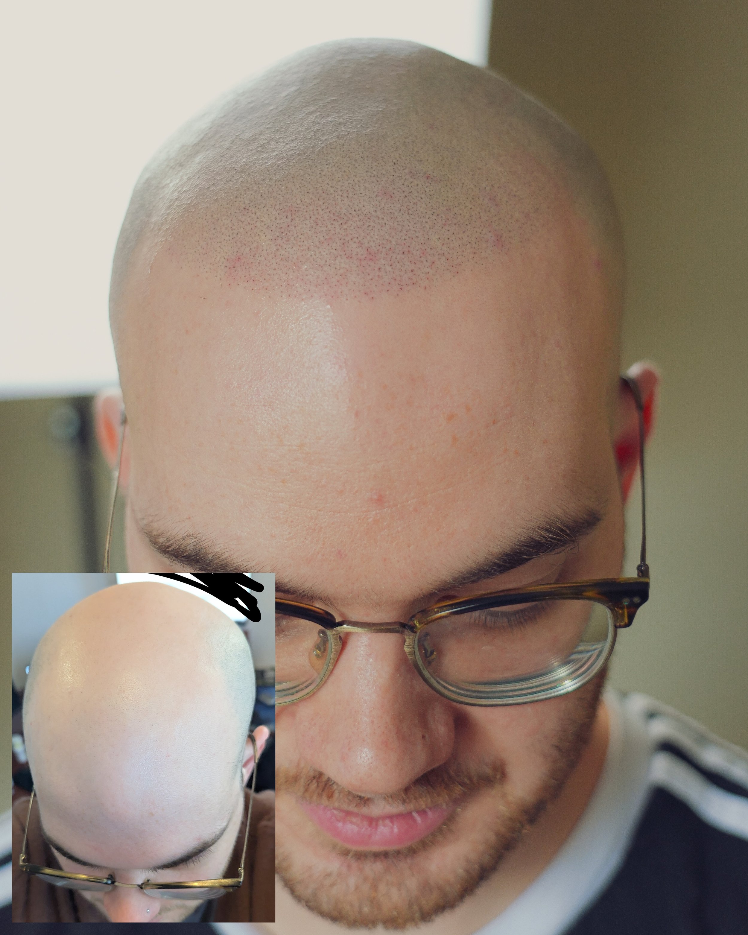 imgcompressors-Untitled 3.PNG