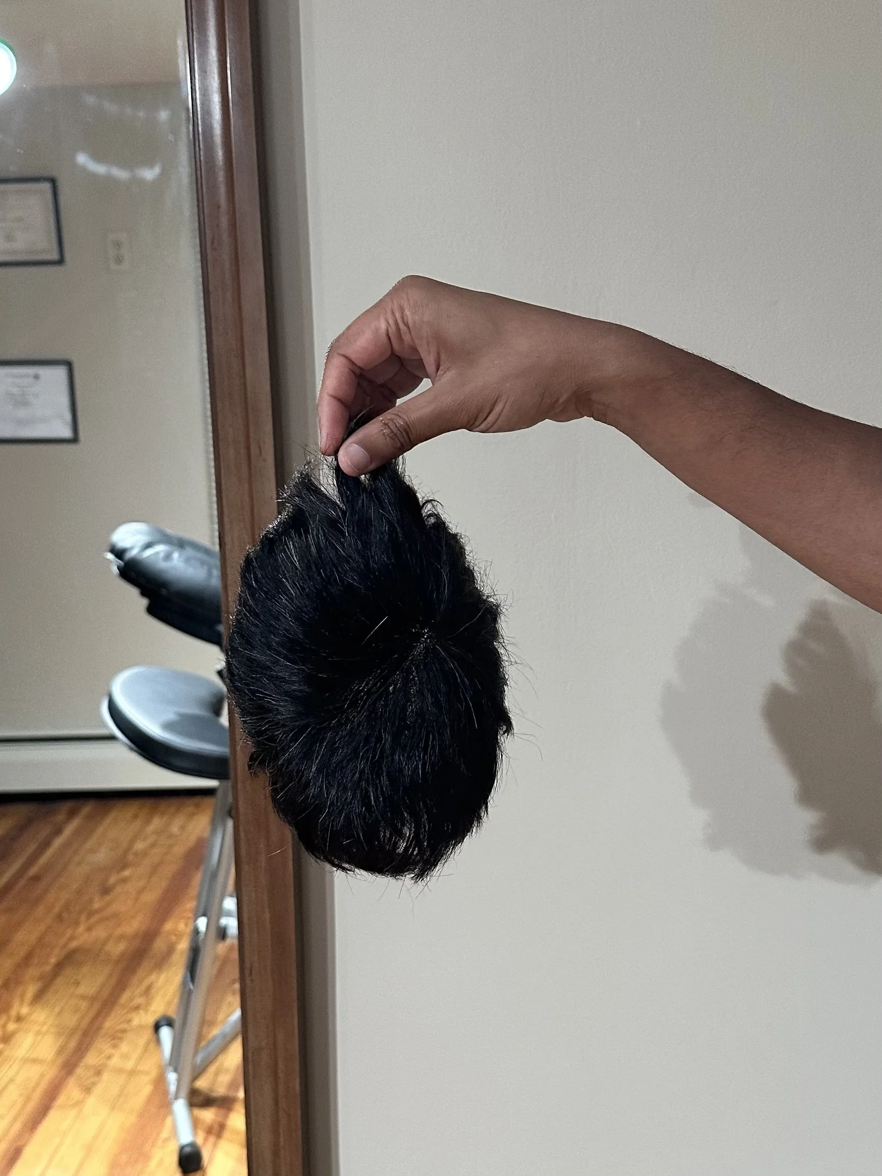 Scalp Micropigmentation vs Hair Systems: Which Is For You?