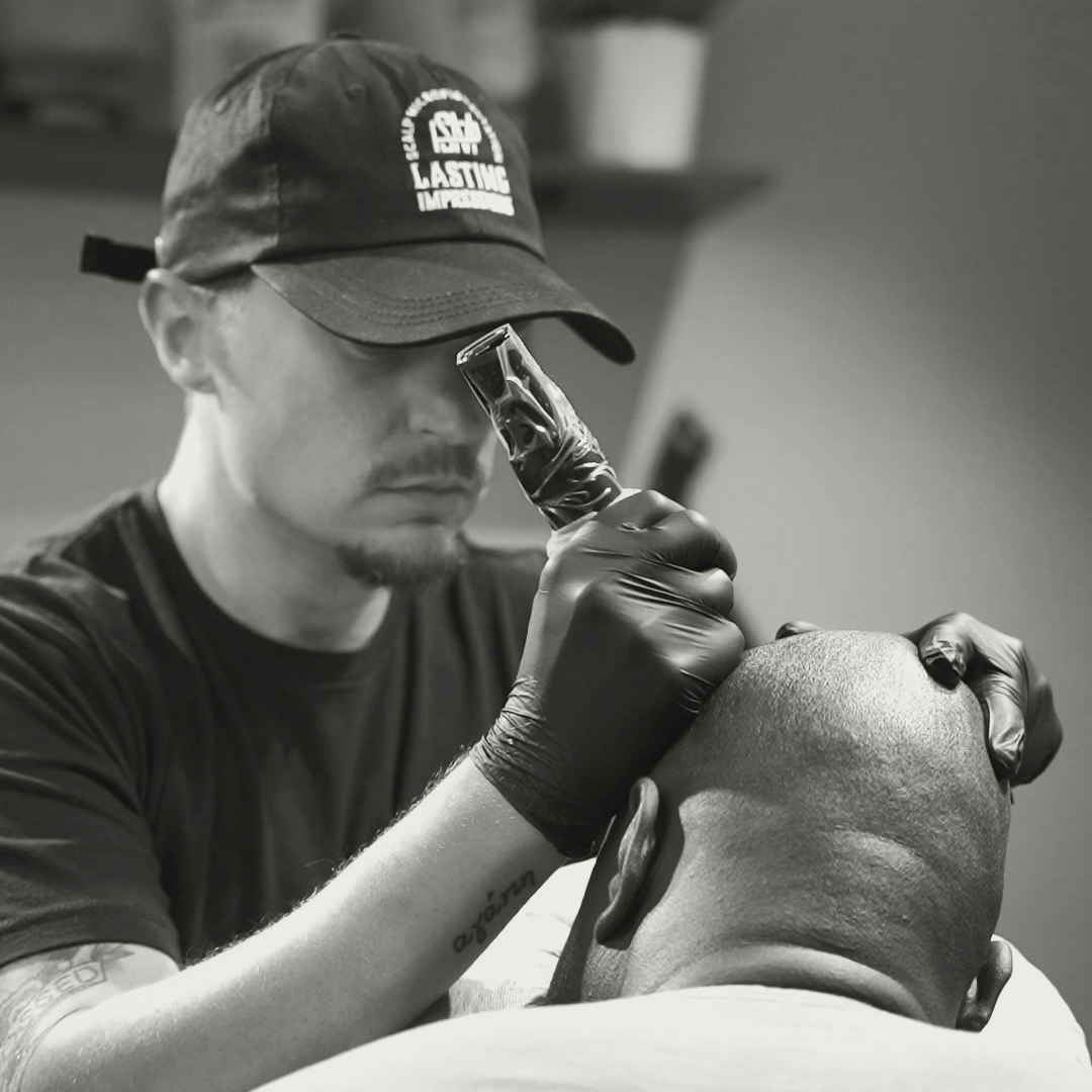 Does Scalp Micropigmentation Hurt? An Honest Answer From a Philadelphia SMP Artist