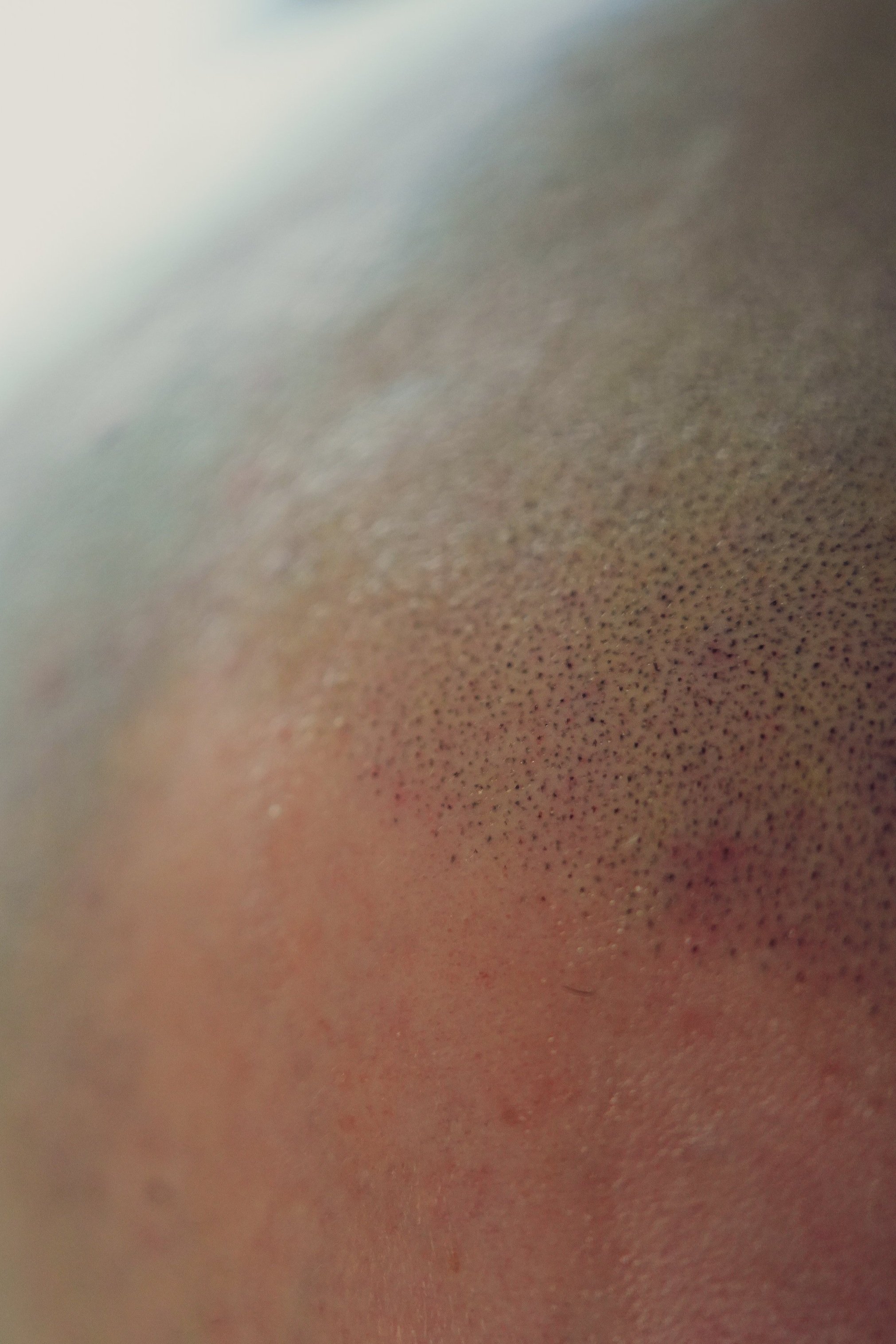 Soft, feathered hairline created with advanced tattoo layering