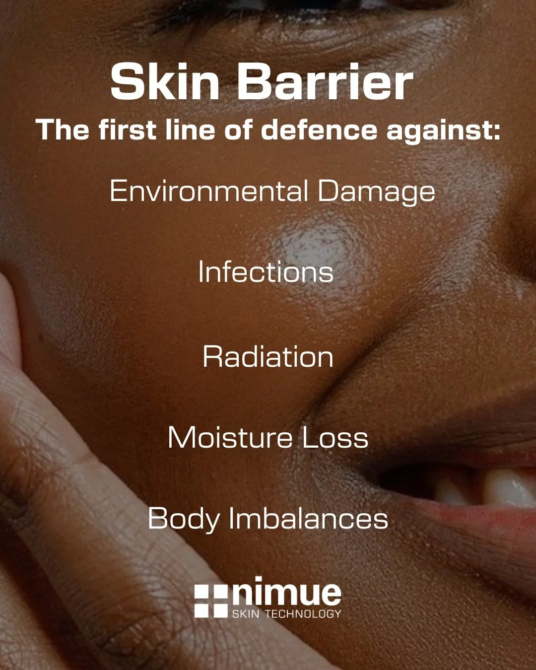 Your skin barrier is more than just the outer layer; it&rsquo;s your body&rsquo;s first line of defence against daily stressors.

Here&rsquo;s how it protects you:

1️⃣ Environmental Damage: Shields against pollution, toxins and harsh weather conditi