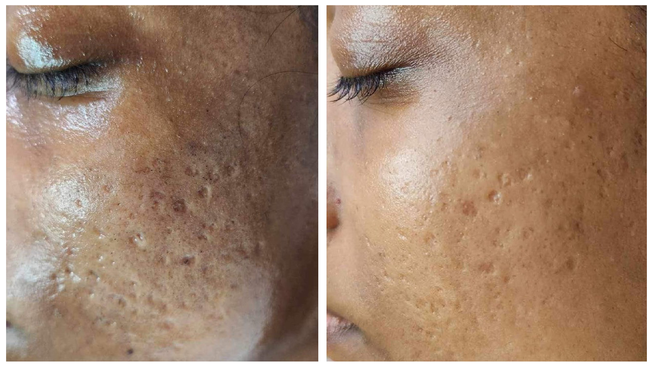 k phyto before and after