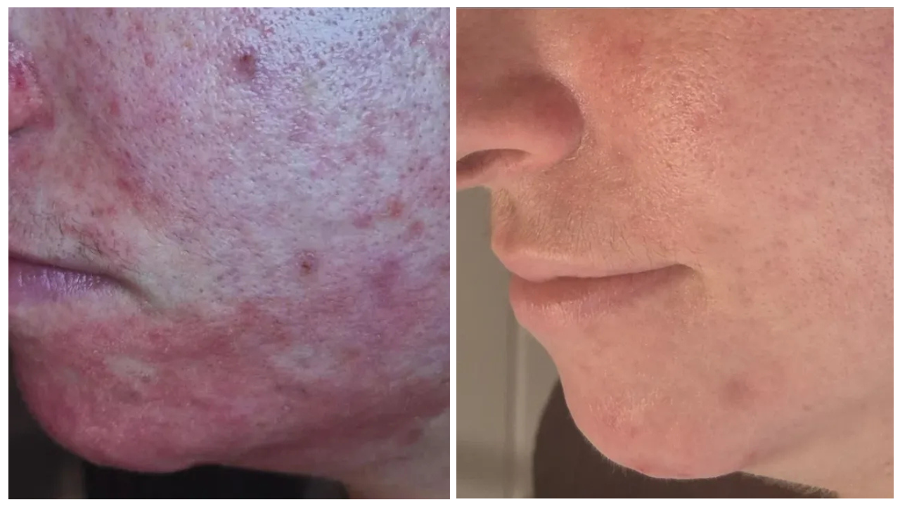nimue before and after