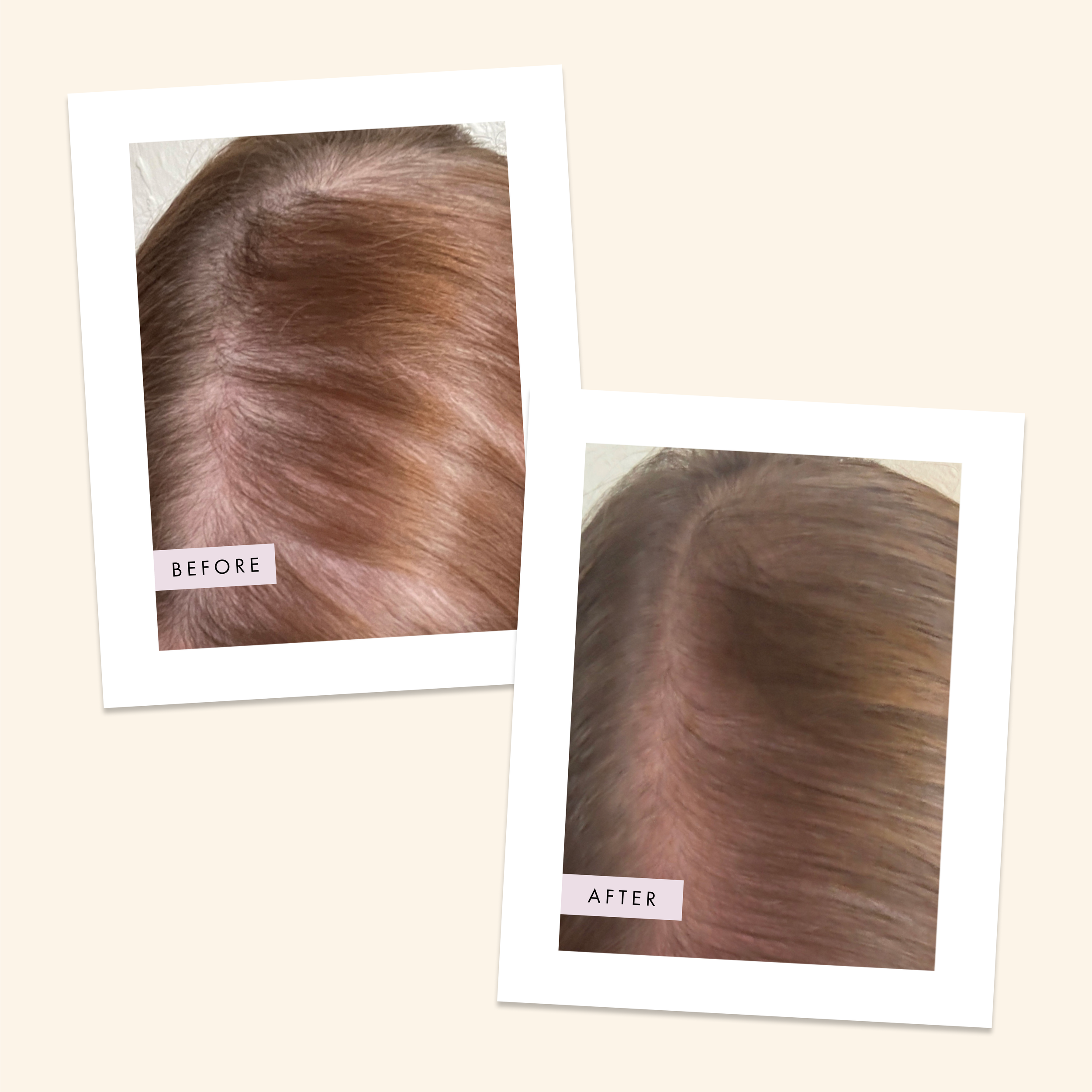 scalp foam before and after