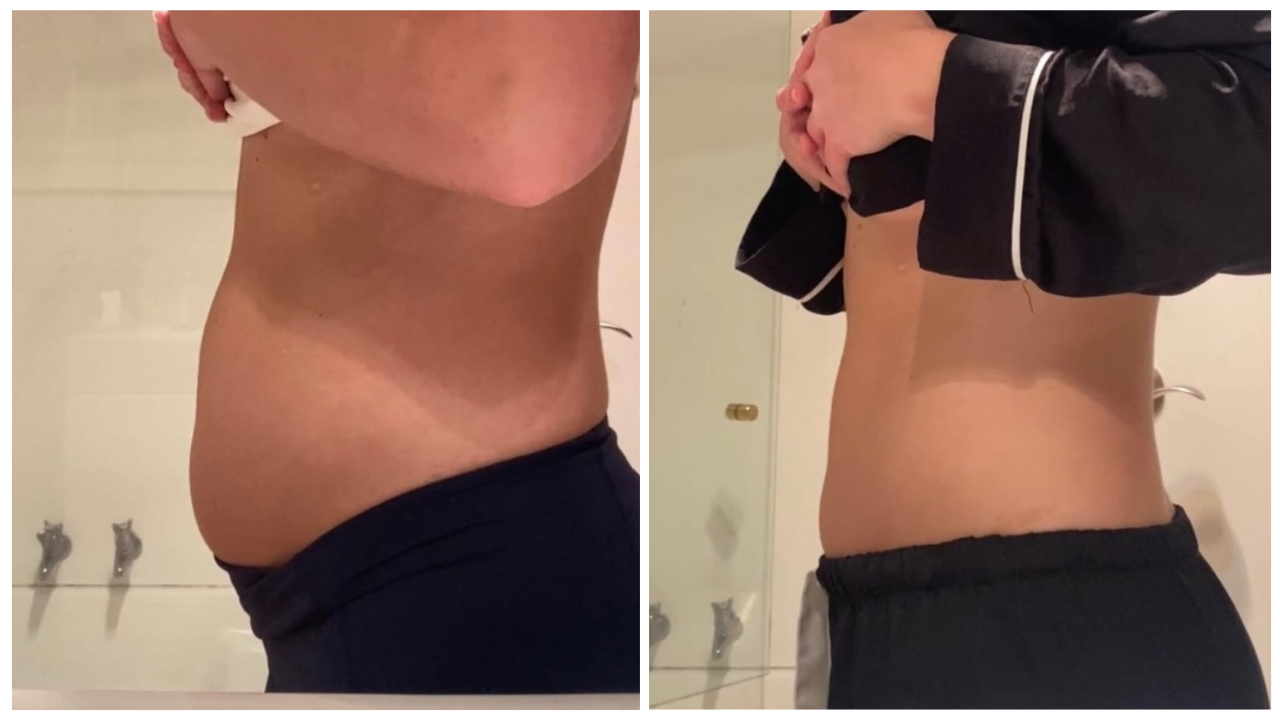 my way up before and after