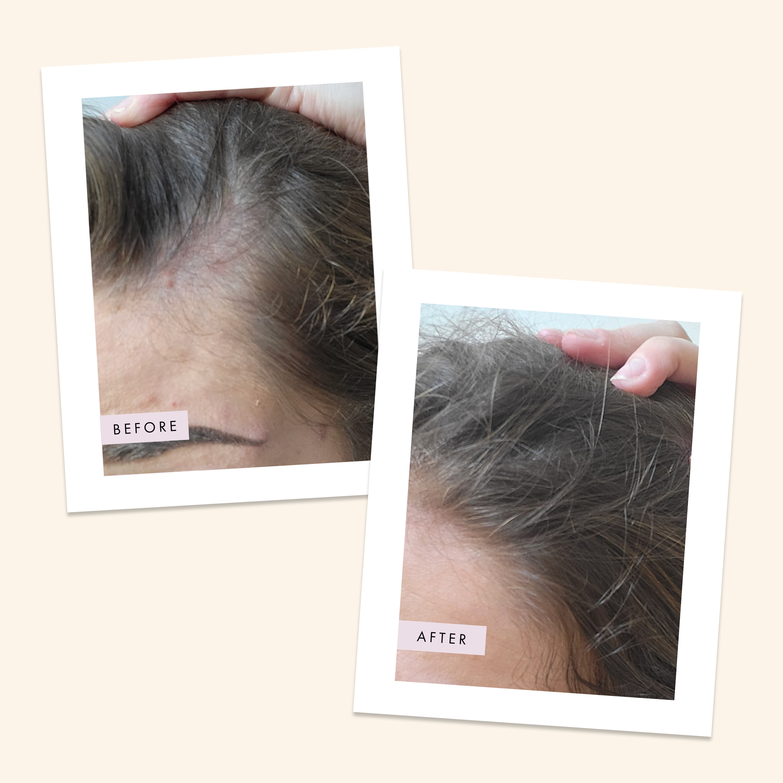 scalp foam before and after