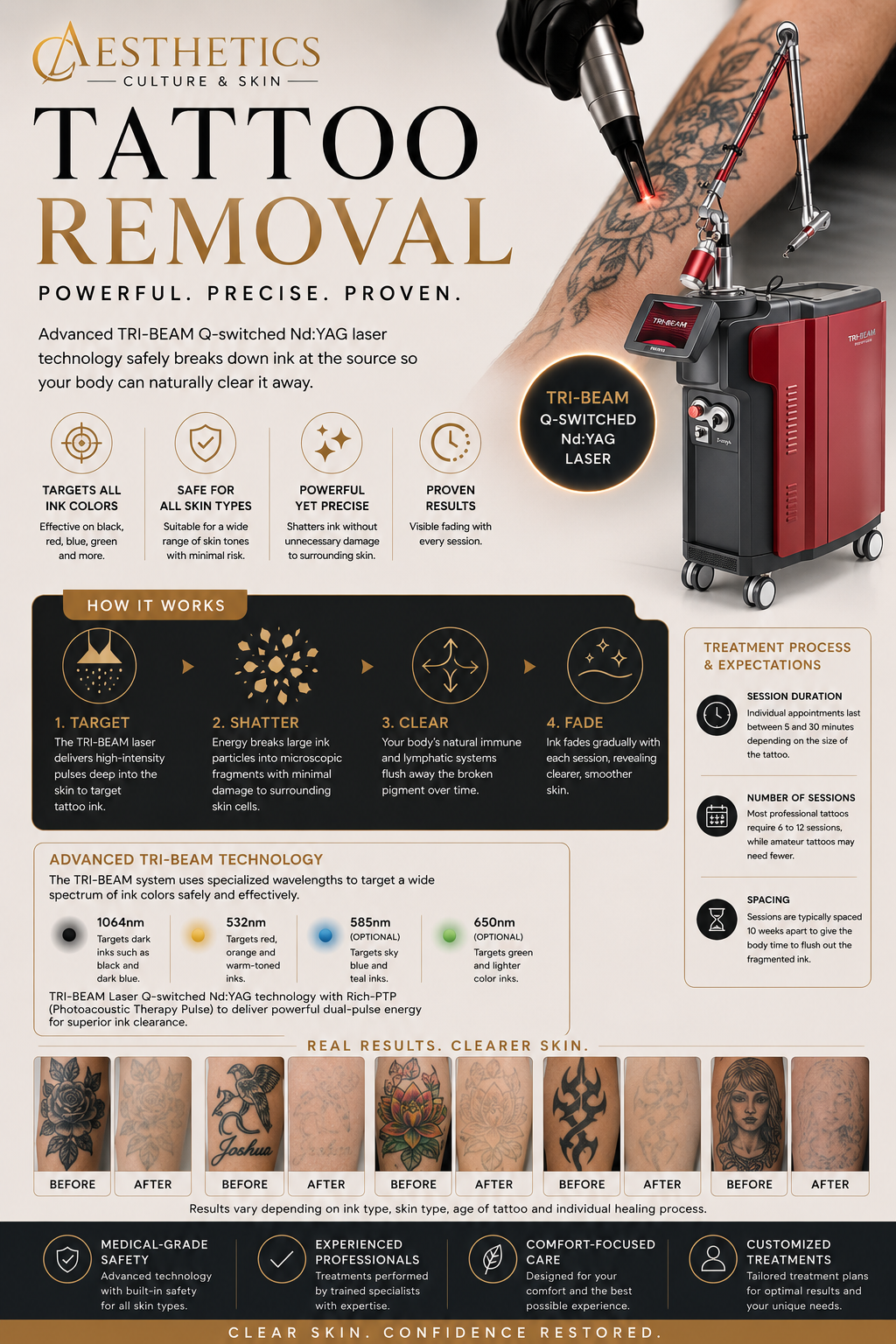 tattoo removal adelaide