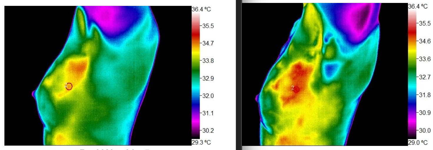Right image is before and left is after 6 months of focused corrective action to decrease inflammation.