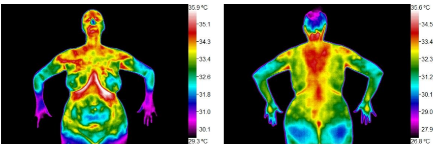 This is a sample of a torso thermograph