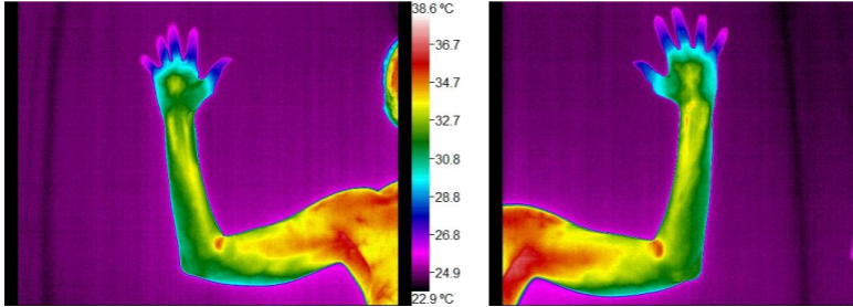 Thermal images of an outstretched arm and hand, showing heat distribution with colors representing temperature levels.