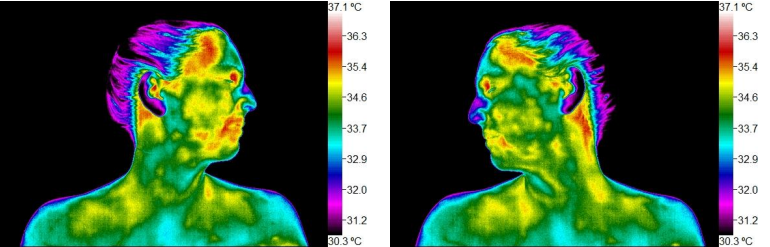 Thermal images of a woman looking to the side, showing temperature variations in her face and neck.