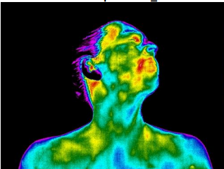 Thermal image of a person with their head tilted back, showing various heat levels on their face, neck, and shoulders.