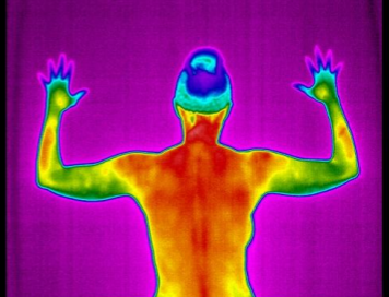 Thermal image of a woman's back showing very high thermal reading associated with pain.