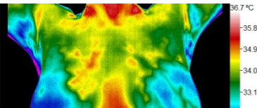 This is an example of a chest or breast image from Leawood thermography