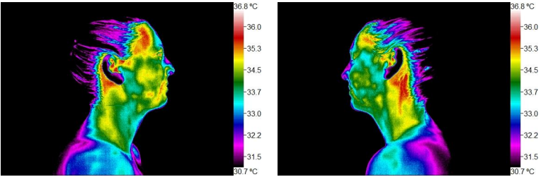 Infrared thermal images of a person's side profile showing temperature variations in the upper cervical region on the right.