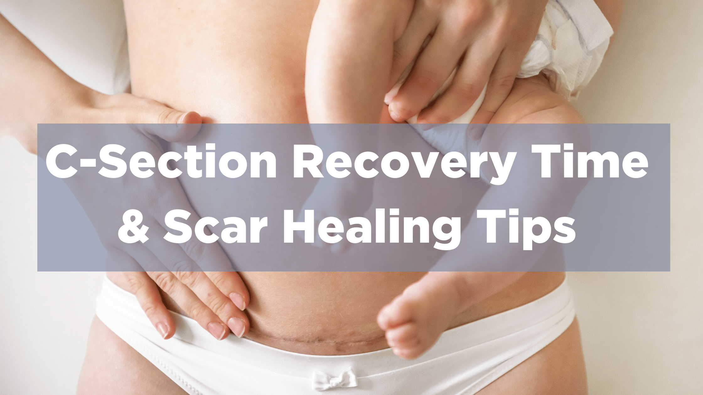 Recovery After C Section