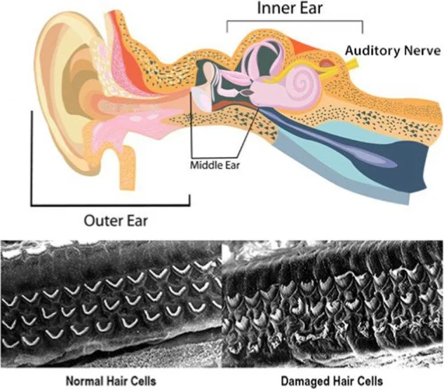 What is otoaging?