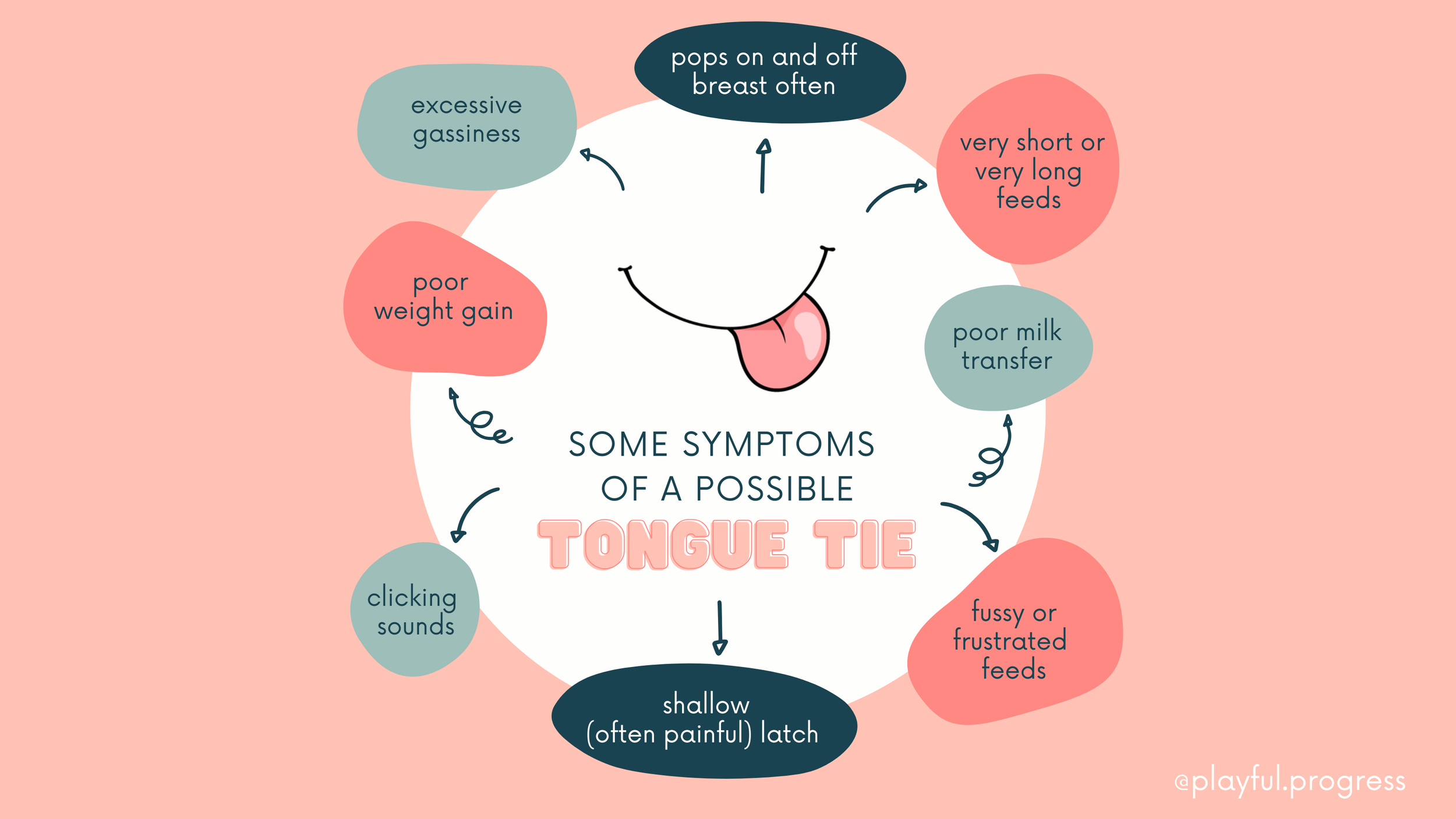 My Baby Is Struggling to Breastfeed — Could It Be a Tongue Tie?