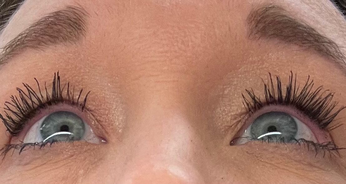Check out these amazing results! After only 2 months of using GrandeLASH-MD lash enhancing serum. The center of the left eyelid had no lashes and now they&rsquo;re full and beautiful! Get yours locally today at Spa Blu! 💙