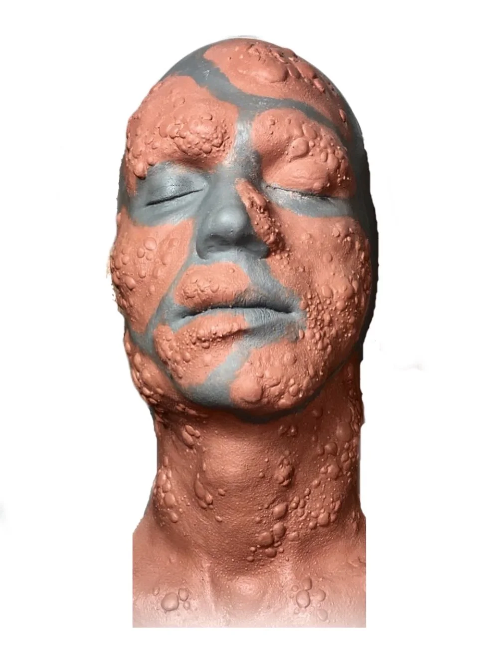 makeup design / sculpting of a character with skin infection / bubbles / cysts all over face - prosthetic makeup design