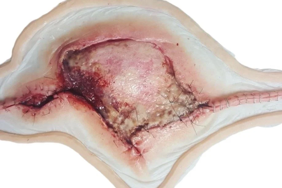 Close-up of a medical model showing a surgical wound with stitches and healing tissue.