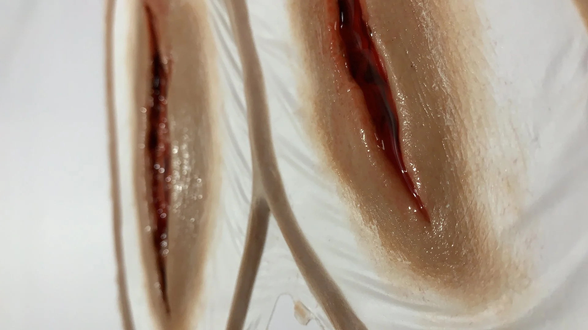 Close-up of a person's mouth with a cut on the lower lip, showing blood inside the wound.