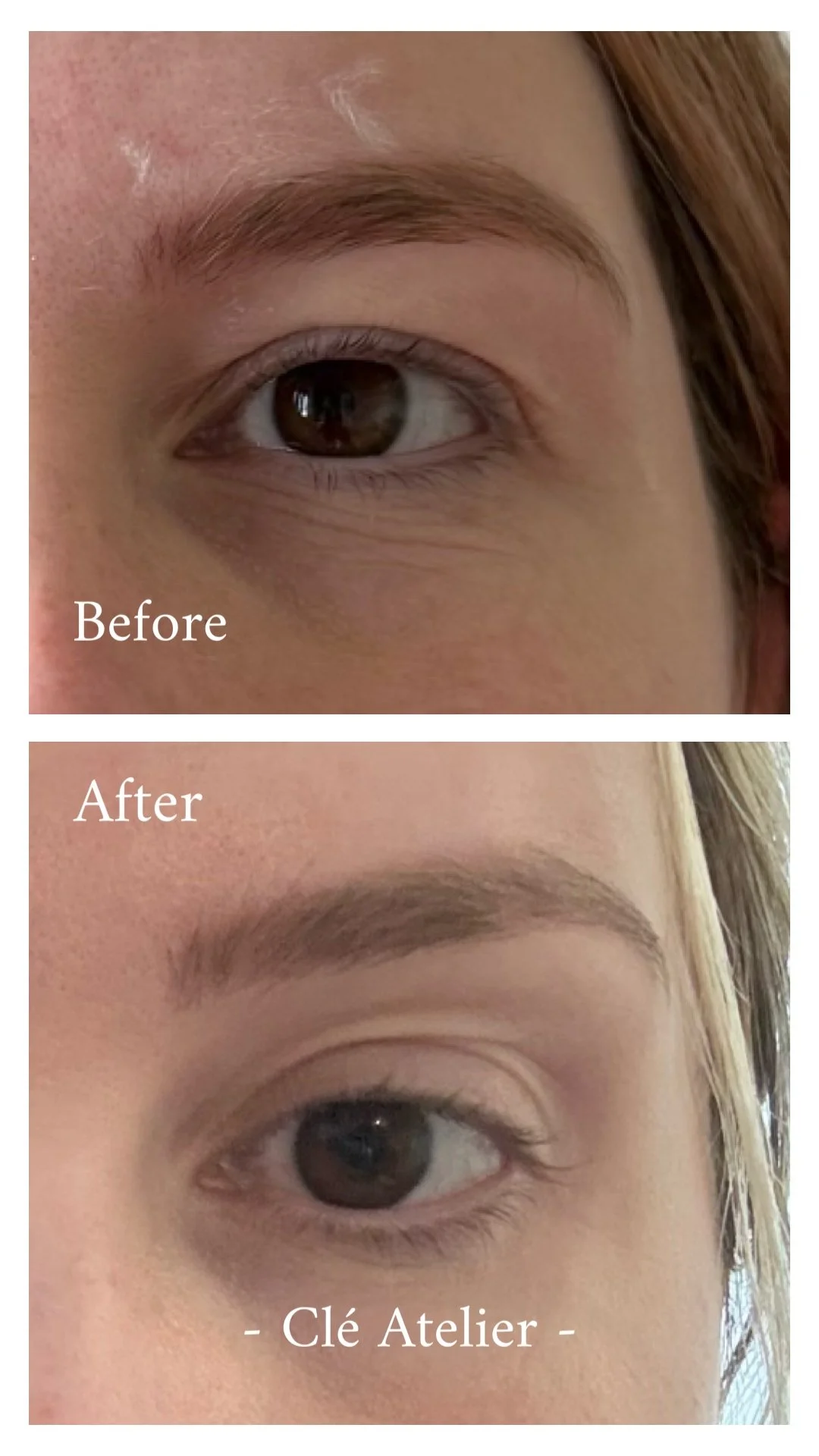 Close-up of a person's eye and eyebrow before and after cosmetic or skincare treatment, showing improved skin texture and fuller eyebrow in the after image.