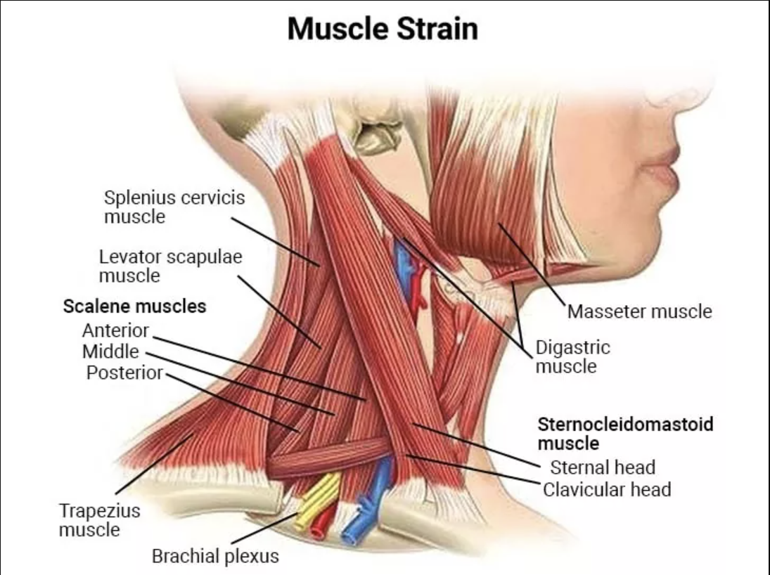 What a pain in the neck!