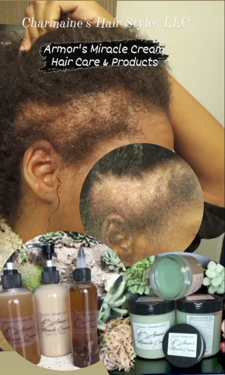 3 month time span; before and after using Amor's Miracle Growth Oil.
